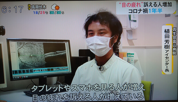 【画像】アイセンター長の植田芳樹医師が富山テレビ「ライブBBT」の取材を受けました