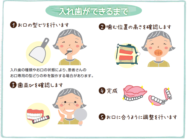 入れ歯ができるまで
1.お口の型どりを行います。入れ歯の種類やお口の状態により、患者さんのお口専用の型どりの枠を制作する場合があります。
2.噛む位置の高さを確認します
3.歯並びを確認します
4.完成
5.お口に合うように調整を行います