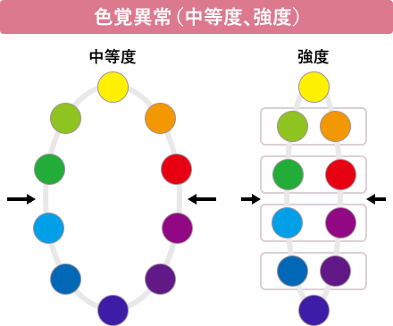 色覚異常(中等度、強度)