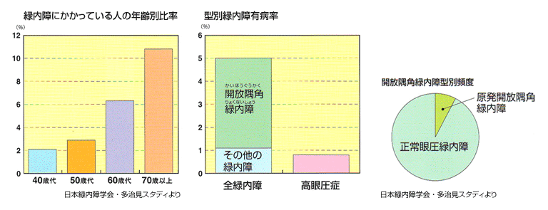 緑内障にかかっている人の年齢別比率