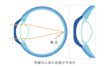 装用後(裸眼時)