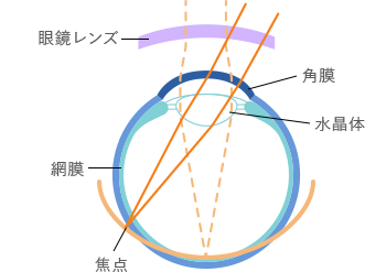 眼鏡装用