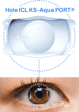 HoleICL KS-Aqua PORT