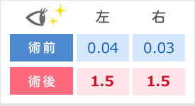 左　術前0.04　術後1.5　右　術前0.03　述語1.5