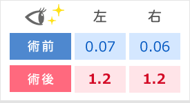 左　術前0.07　術後1.2　右　術前0.06　述語1.2