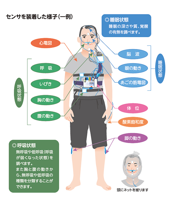 センサー装着